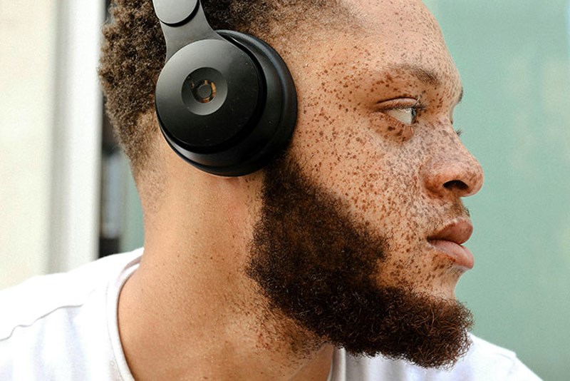 Crnac sam, imam bijele pjegice