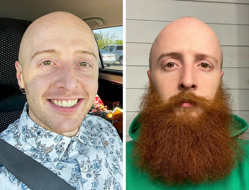 8. "Mislim, znam da je to samo brada. Ali kad gledam ove dvije fotografije ne vidim istu osobu na njima"