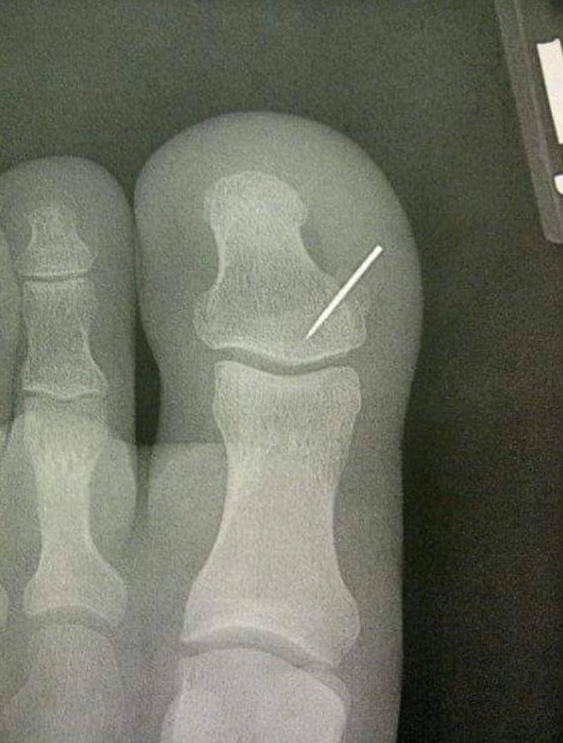 "Supruga je prije nekoliko dana izgubila iglu, a sad sam je ja pronašao..."