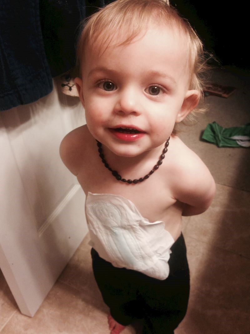 14. "Mislio je da je pronašao flaster..."