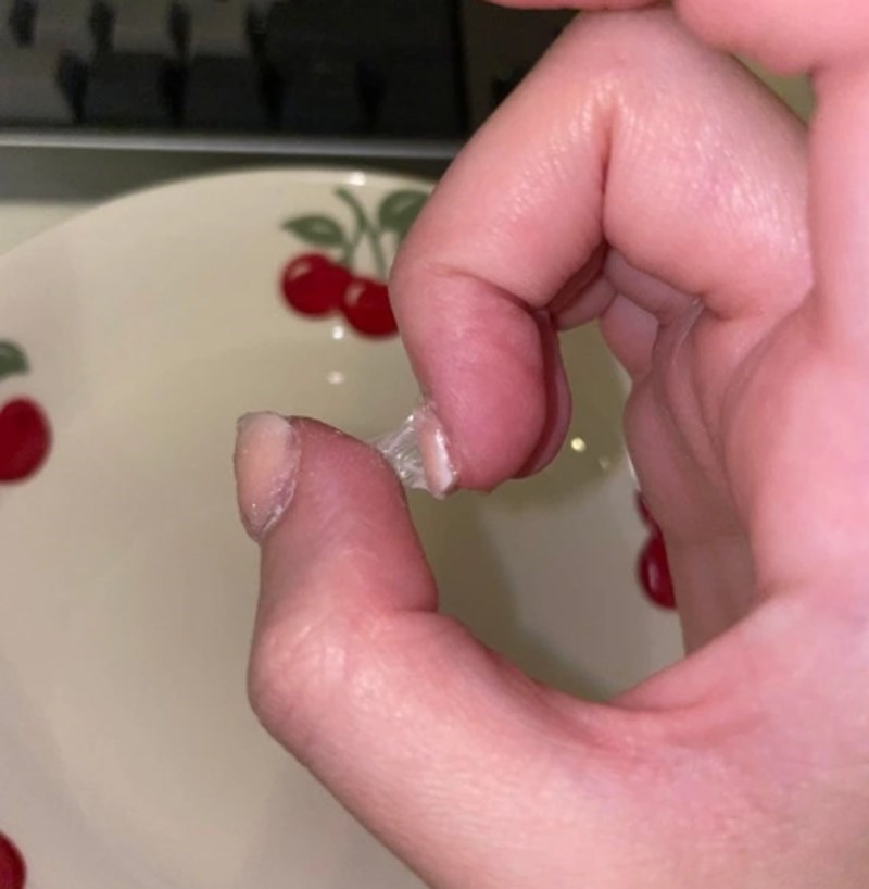 1. "Poslala sam im u salon ovu sliku i rekli su da sam ja kriva, a ne oni koji su mi tretirali nokte."