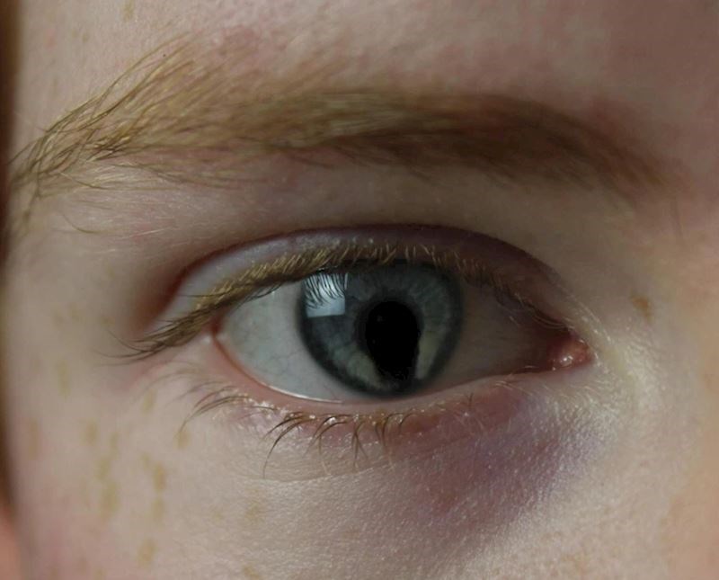 "Zbog ove mrlje u oku ljudi često misle da sam prolio tintu ili nešto. Ali jednostavno tako izgleda"