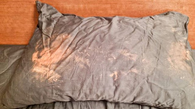 5. "Nikad nemojte ići spavati ako ste se namazali kremom protiv prištića. U suprotnom će vam jastučnice izgledati kao moja!"