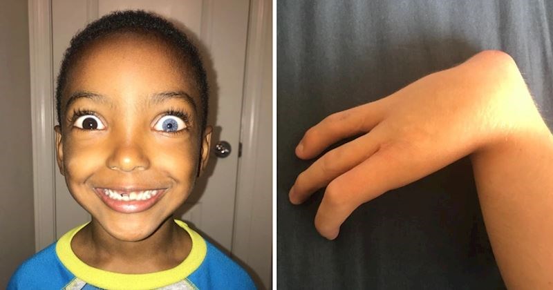 Ovi ljudi rođeni su da bi se isticali u gomili, pogledajte njihove neobične fizičke karakteristike