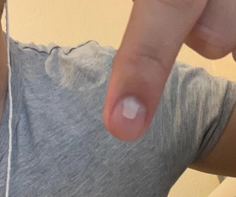 8. "Na istom prstu mi rastu dva nokta otkad sam imao osam godina. To se počelo događati nakon što sam udario vrata auta u prst."