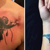 10+ ljudi koji su svoje ožiljke pretvorili u prava umjetnička djela i sad imaju predivne tetovaže