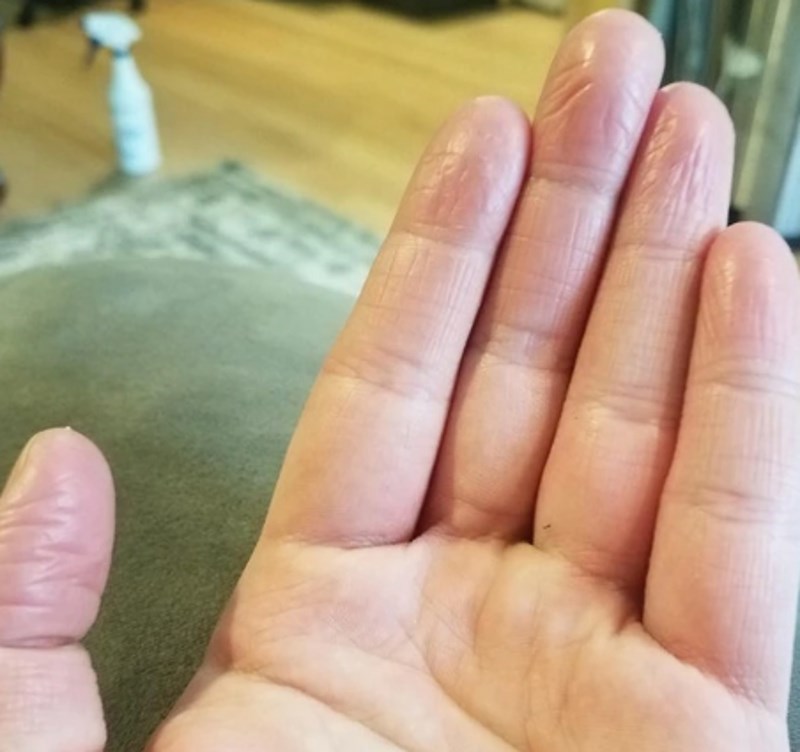 2. "Moji prsti su takvi da uopće nemam otisak."