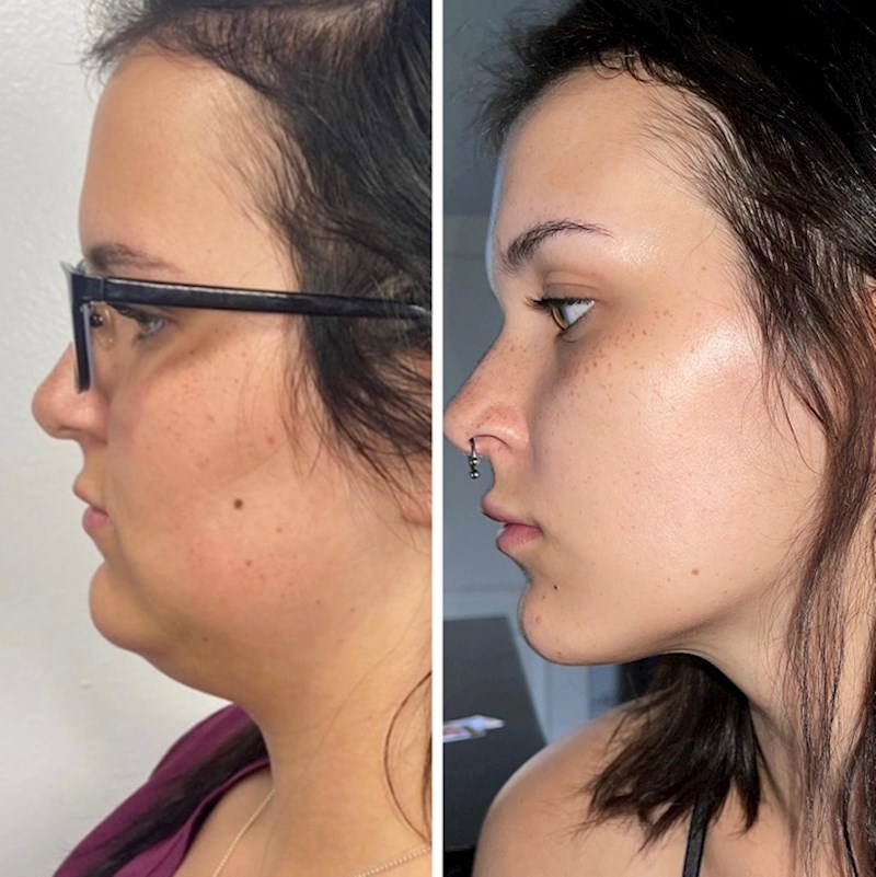 6. "Izgledam kao potpuno druga osoba"