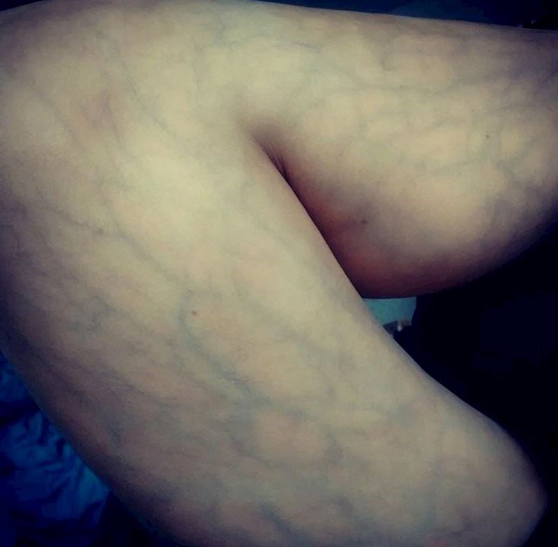 "Kad sam se rodio cijelo tijelo mi je ovako izgledalo. Sada mi ovako izgleda samo lijeva noga"