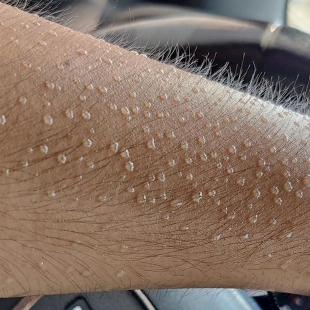 10. "Ovako izgleda moja ruka kad se znoji. Kapljice izgledaju savršeno."