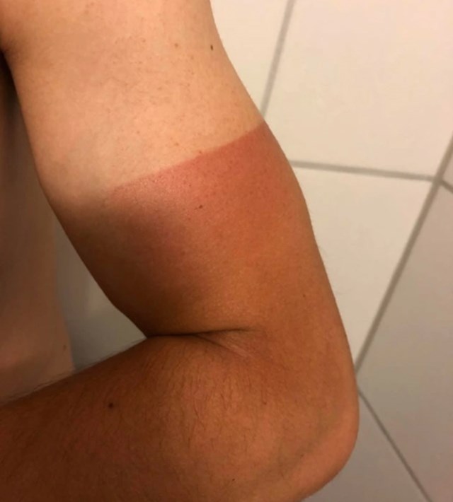 "Iduće godine po gradu hodam u dugim rukavima."