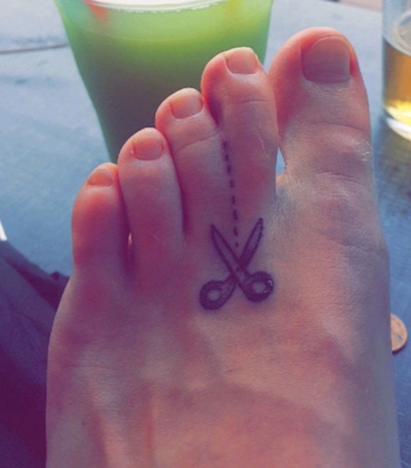 U slučaju da liječnicima jednog dana treba "šalabahter" za razdvajanje prstiju