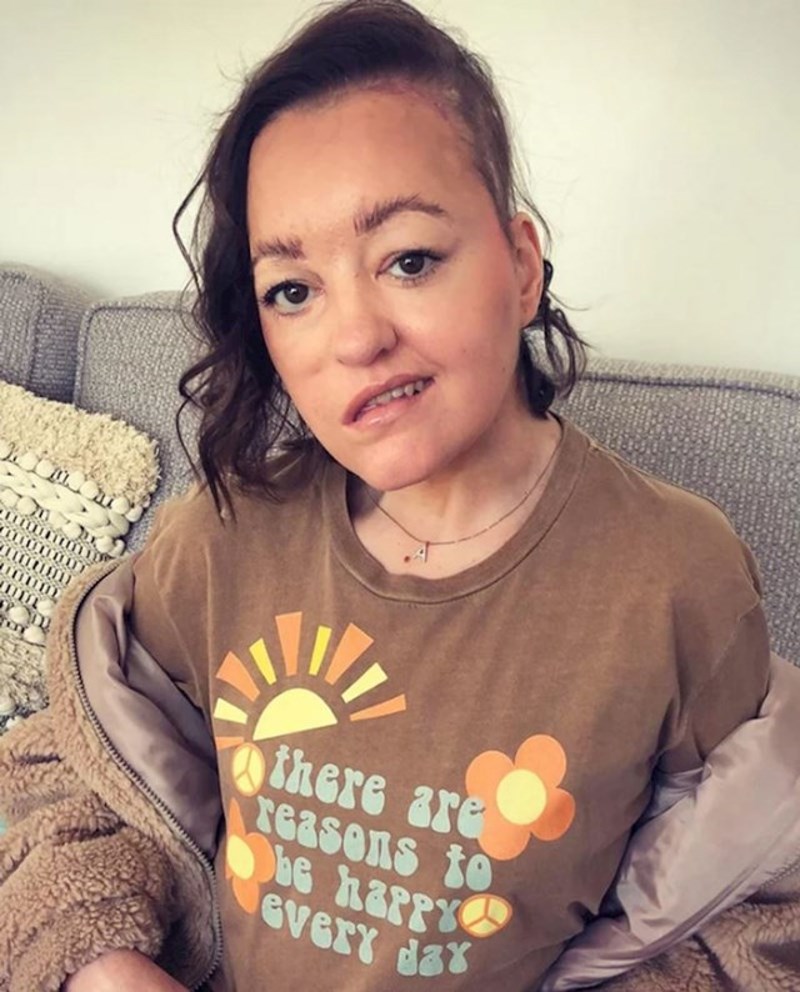 4. Žena je podijelila fotku kako bi obilježila sedmi tjedan od uspješne neurološke operacije!