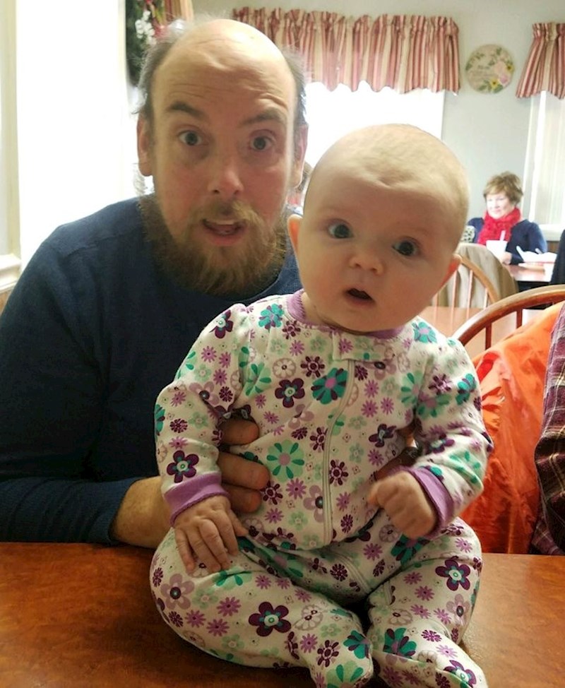 9. "Moja kćer i ja imamo istu udubinu na čelu"