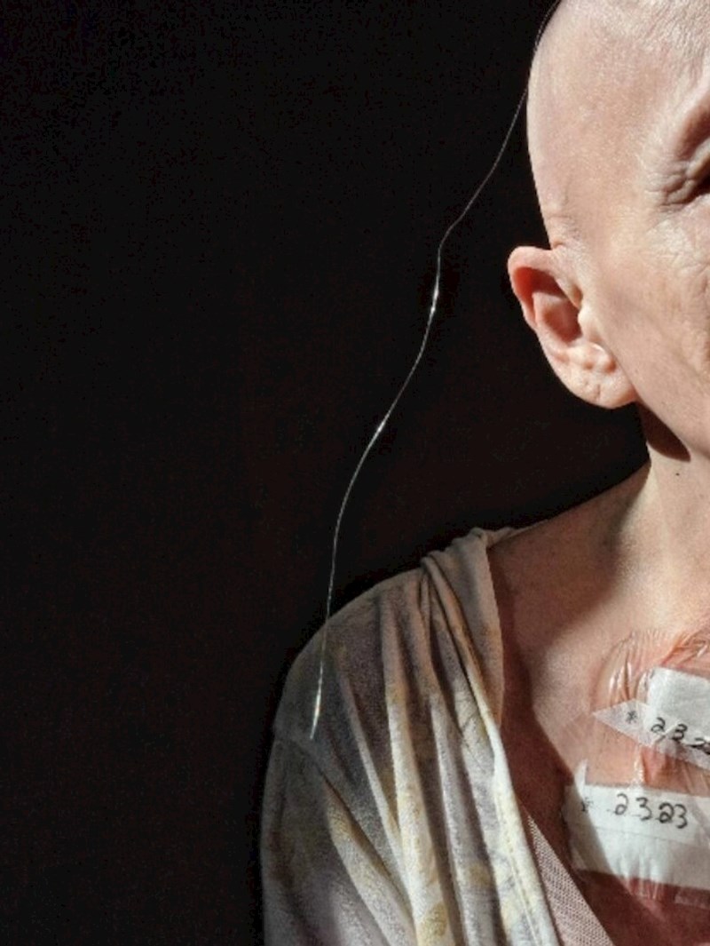 "Mamina posljednja vlas kose. Odlučile smo snimiti ovaj poseban portret. Još četiri mjeseca kemoterapije i nadamo se da će sve nakon toga biti dobro"