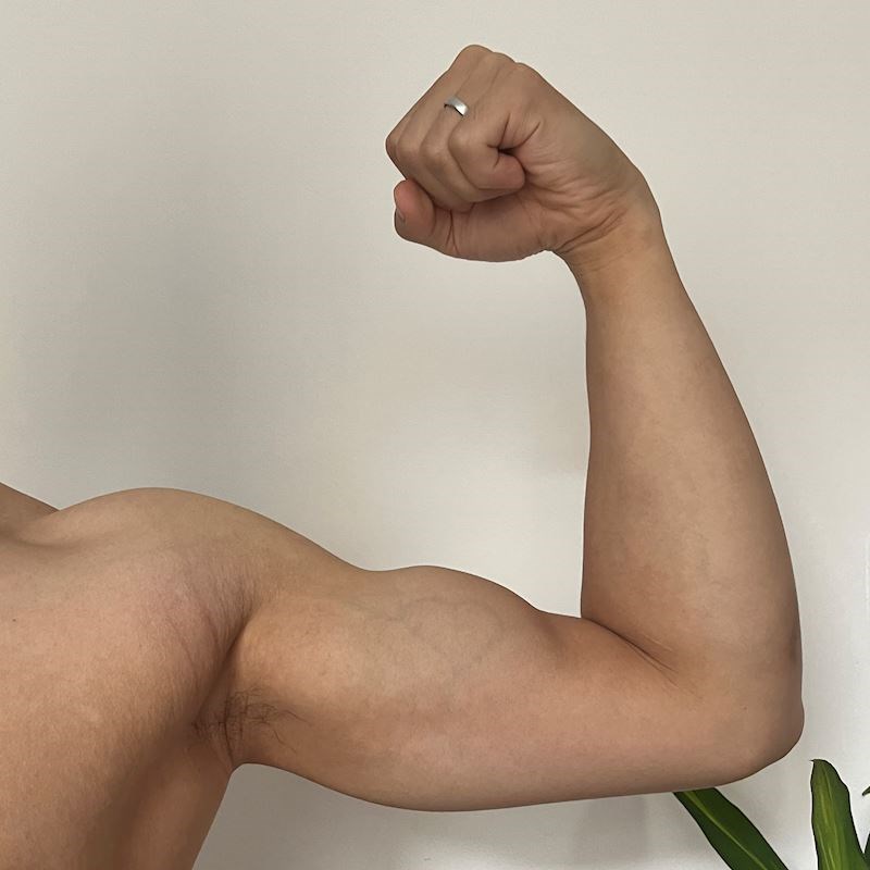 "Vena na bicepsu mi izgleda kao srce"