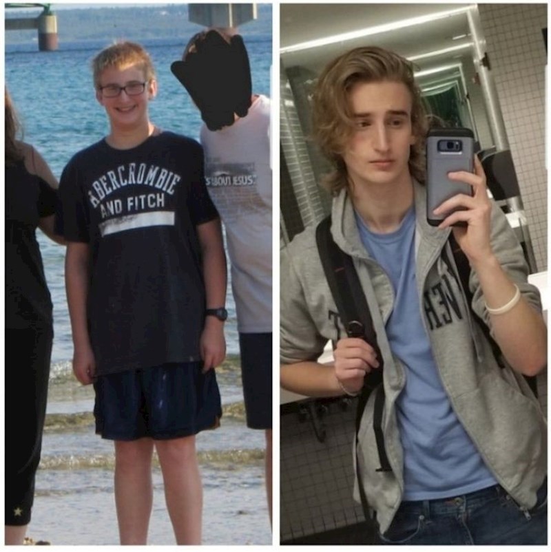 "Osam godina razlike i lasersko uklanjanje dioptrije"