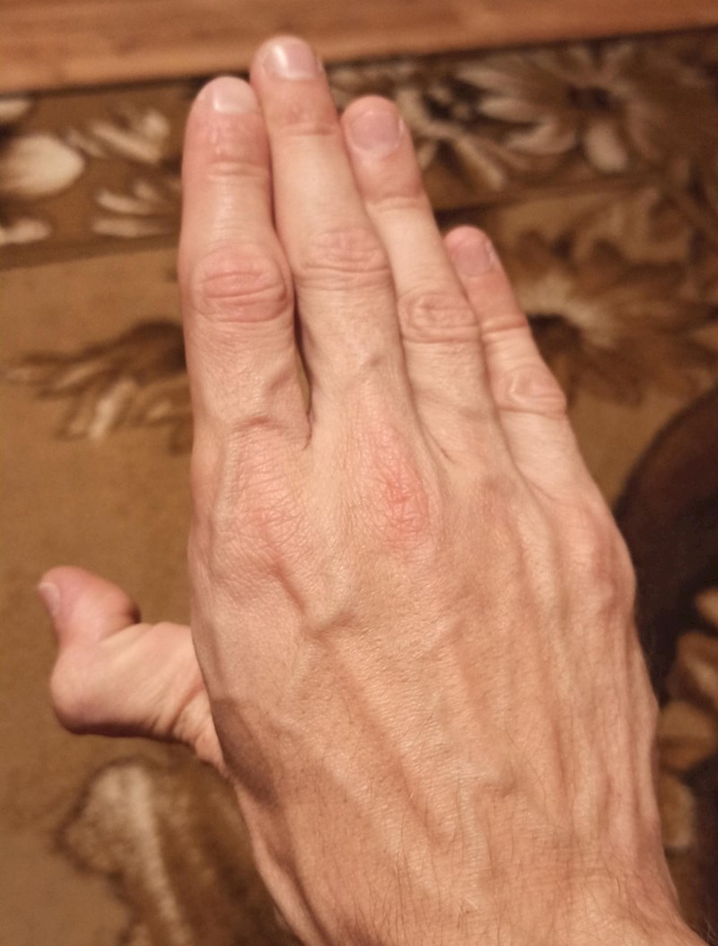 10. "Moj neobičan palac"