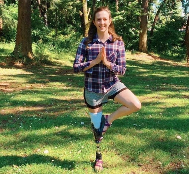 4. "Više od 40 dana nisam mogla koristiti protezu i normalno hodati. Mogućnost da hodam nikad ne uzimam zdravo za gotovo"