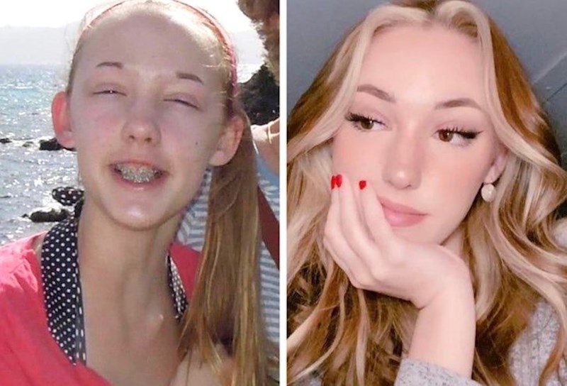 12. "Obojila sam kosu, počela crtati obrve i sad konačno izgledam kao "normalna" osoba. Ali za to je trebalo proći nekoliko godina"