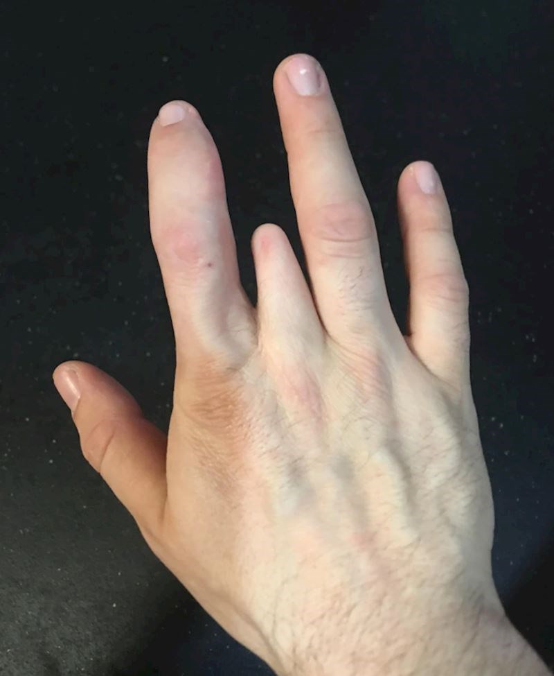 "Rodio sam se s pola srednjeg prsta"