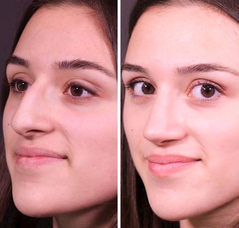 7. "Na drugoj fotografiji izgledam kao druga osoba"