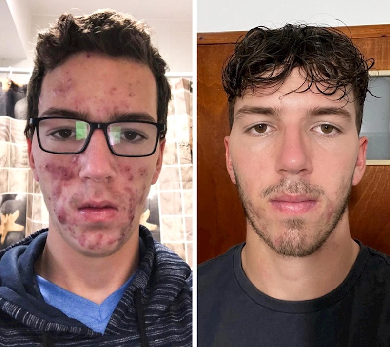 "Jako sam zadovoljan s fizičkom promjenom otkad sam imao 15, do sad kad imam 18 godina"