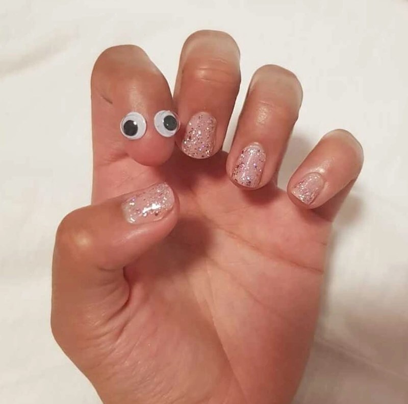 "Kad već nemam nokat, onda se barem mogu našaliti"