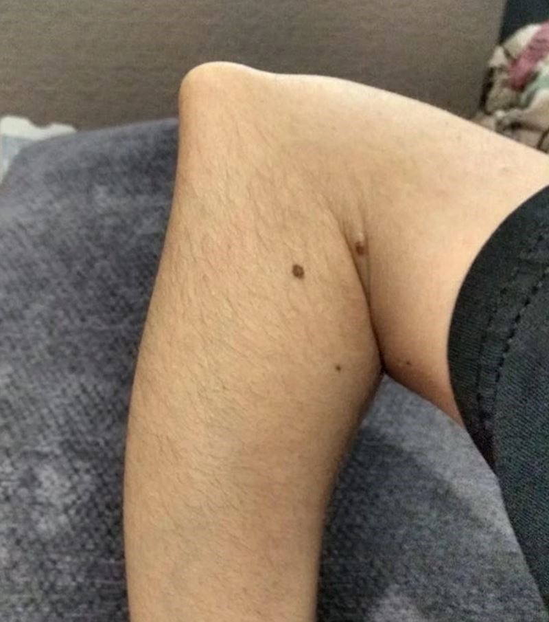 6. "Ovako izgleda moj lakat kad savijem ruku"