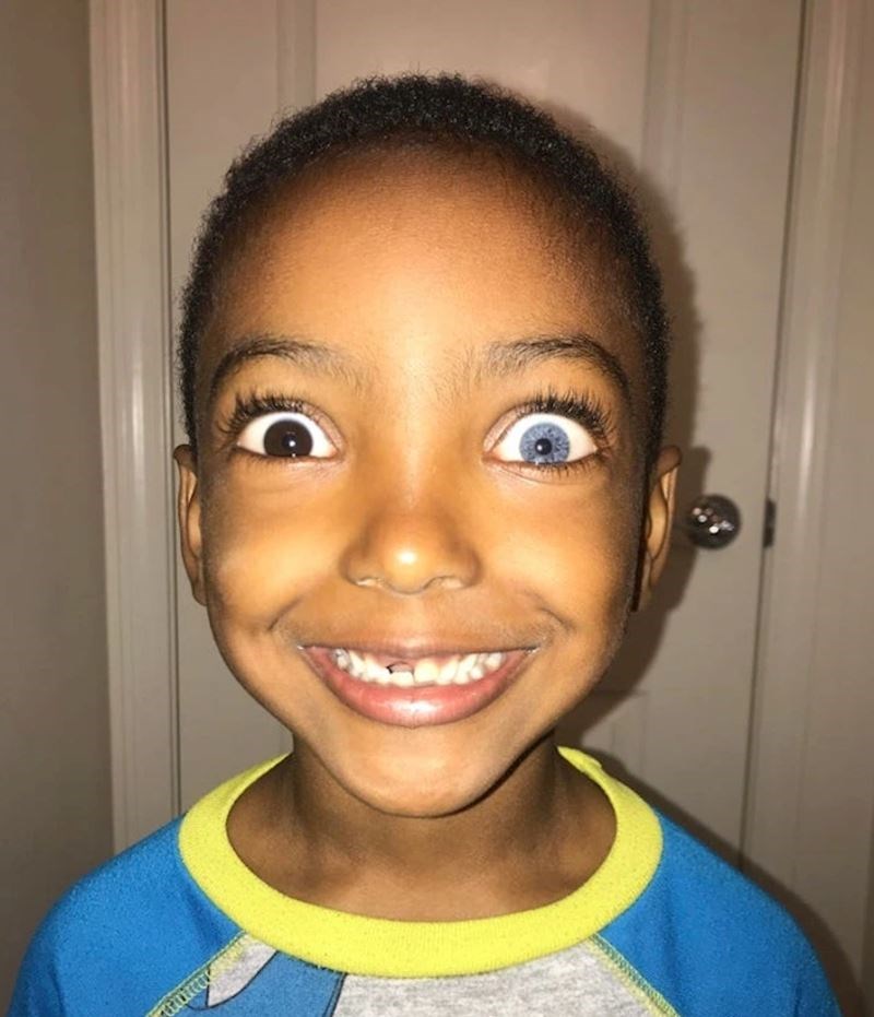 2. "Moj mali brat ima različite boje očiju"