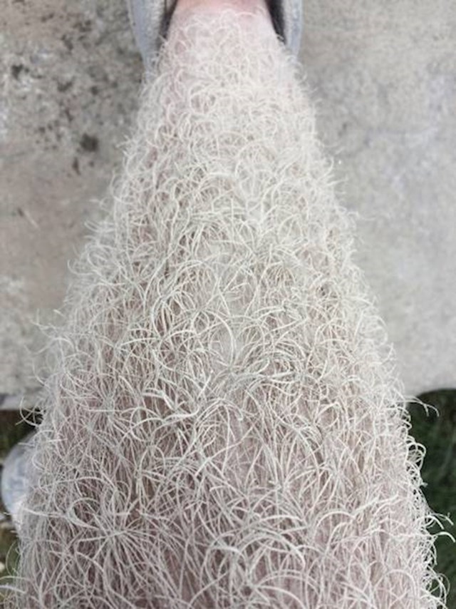 Čovjek koji radi u kamenolomu slikao je dlake na nogama, bile su bijele od prašine.