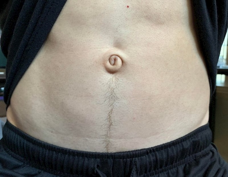 12. "Ljudi su uvijek iznenađeni kad vide moj neobičan pupak"