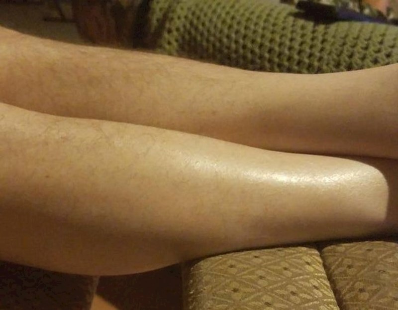 8. "Mom tatu su na području na kojem tijekom cijelog života nosi čarape prestale rasti dlake"