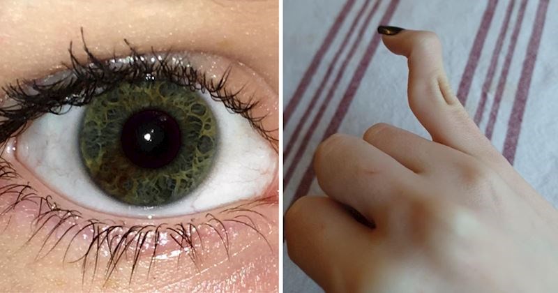 14 ljudi koji se zbog svojih neobičnih fizičkih karakteristika svakodnevno ističu u masi