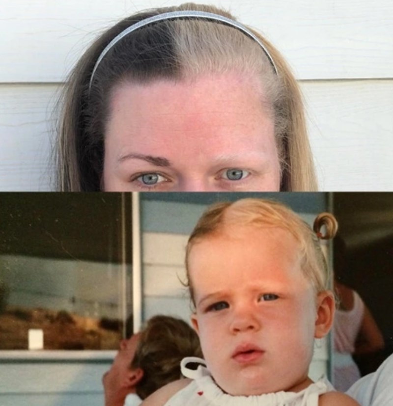 4. "Moja sestra je oduvijek imala pola plavu, a pola smeđu kosu."