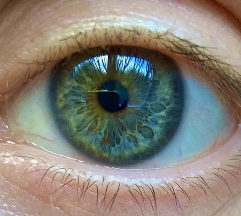 10. "Imam jako neobičan, ali baš fora uzorak u oku"