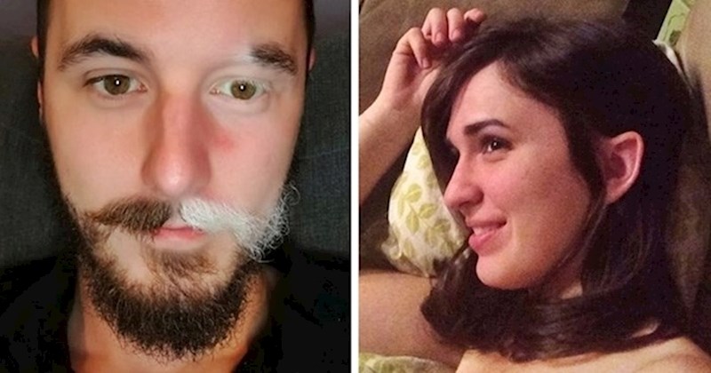 17 ljudi koji zbog neobičnih detalja na svom tijelu izgledaju unikatno