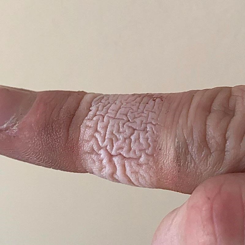 "Izgleda li i vama koža ovako nakon što skinete flaster? Meni svaki, ali baš svaki put"