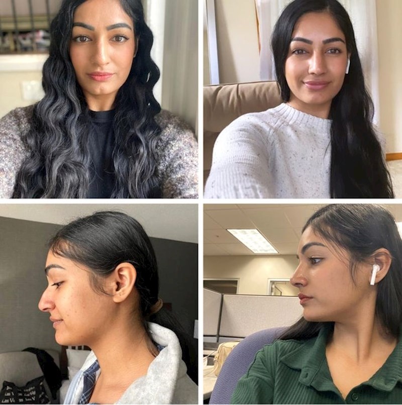 3. "Otkad sam išla na operaciju prije tri tjedna, oduševljena sam svojim novim izgledom. Znam da ljudi misle da je do čiste estetike, ali je u mom slučaju bilo potrebno ići na operaciju i iz zdravstvenih razloga"