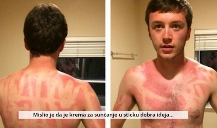 10+ ljudi kojima su se dogodile bizarne nezgode koje su im potpuno pokvarile dan