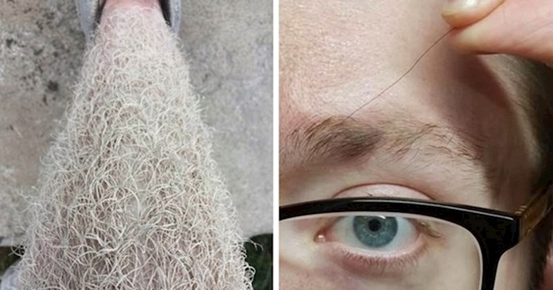 20 fascinantnih fotografija koje vam neće tako lako izaći iz glave