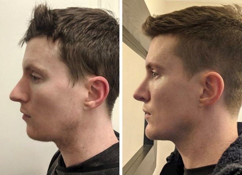 6. "Dva i pol mjeseca nakon nekoliko operacija, konačno se osjećam kao ja"