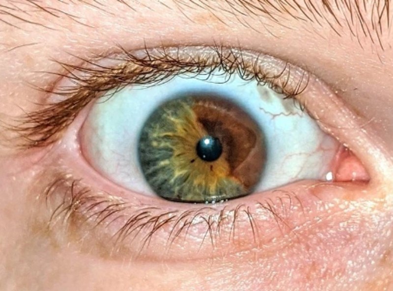 6. Baš jedinstveno oko