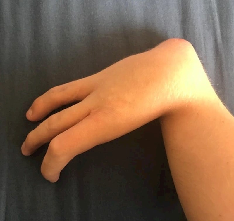 4. "Moja tri prsta i ja"