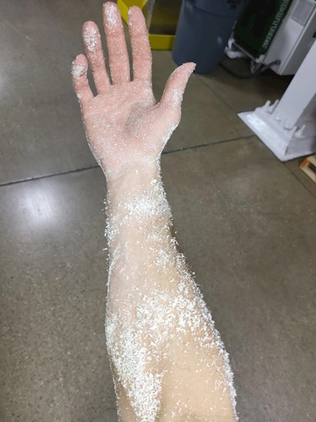 1. "Ovako je izgledala moja ruka nakon 10 minuta na poslu..."