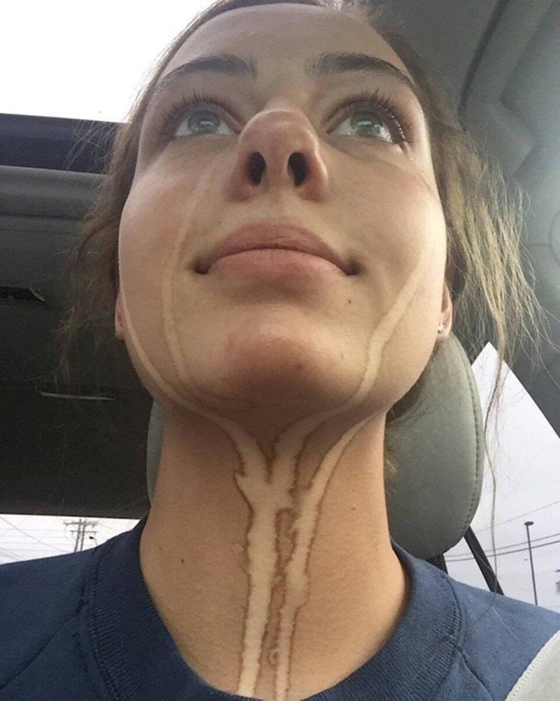 "Sprej za samotamnjenje mi je nadražio oči i sad izgledam ovako..."