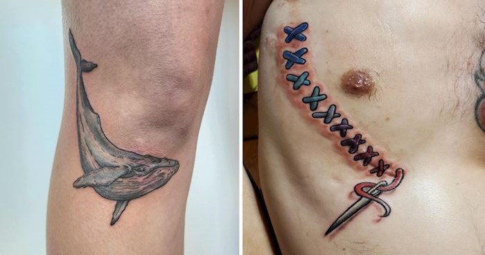 10+ ljudi koji su svoje ožiljke odlučili pretvoriti u predivne tetovaže, ovo su prave kreacije