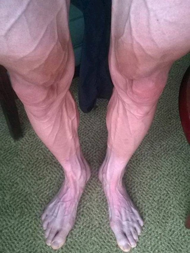 Ovako izgledaju noge biciklista koji je vozio Tour de France.