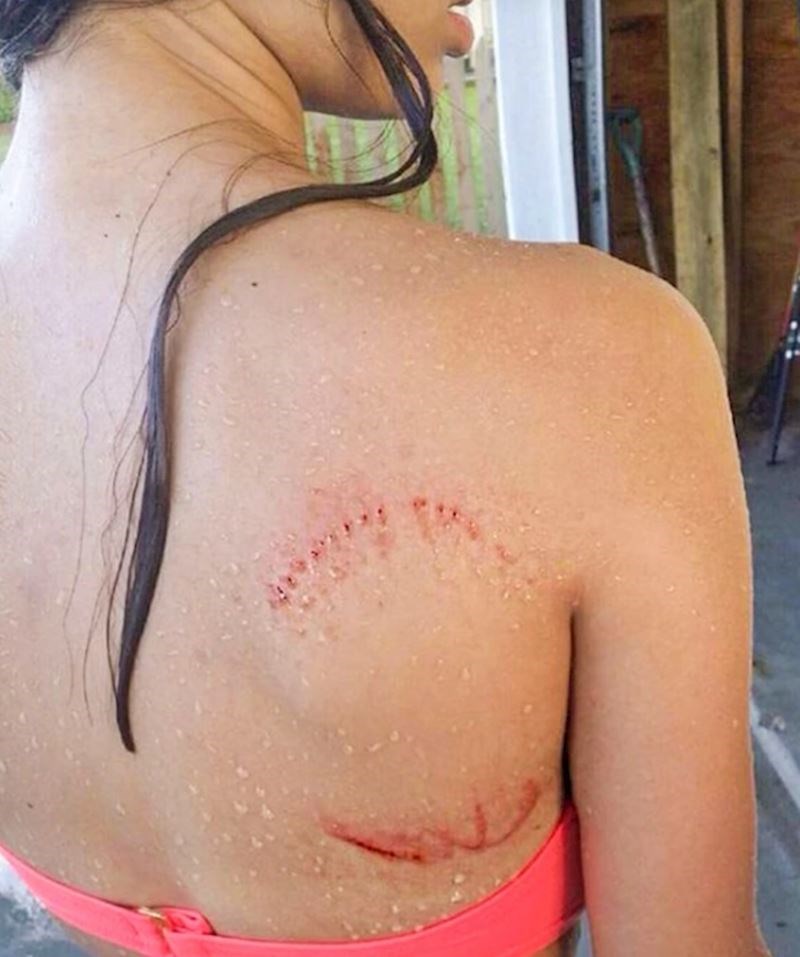 6. "Ugrizao me morski pas, ali srećom nije bio velim pa sam uspjela pobjeći."