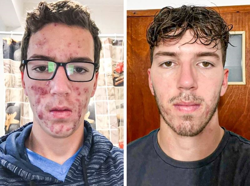 "15 - 18 godina, oduševljen sam promjenom i napretkom!"